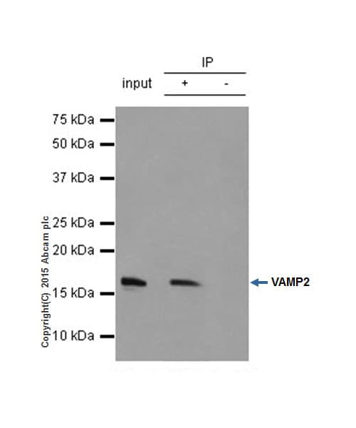 Vamp2 Antibody Epr12790 Bsa And Azide Free Ab214590  Immunoprecipitation Img268