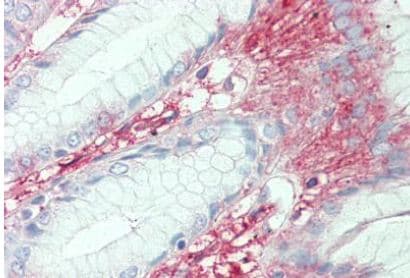 Anti-SLC7A2/CAT2 antibody(AB140831)