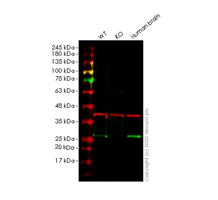 Mras Antibody Epr12457 Ab176570  Western Blot Img5924