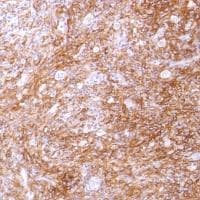 Anti-CD14 antibody [SP192](AB183322)