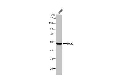 Hck Antibody Hl1673 Ab308234  Western Blot Img407224
