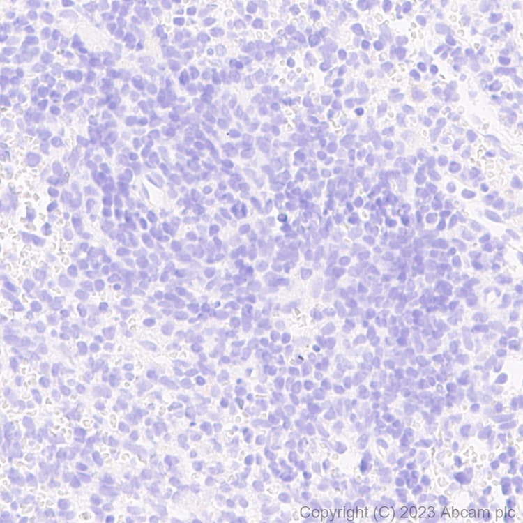 Anti-mCherry antibody [EPR20579](AB213511)
