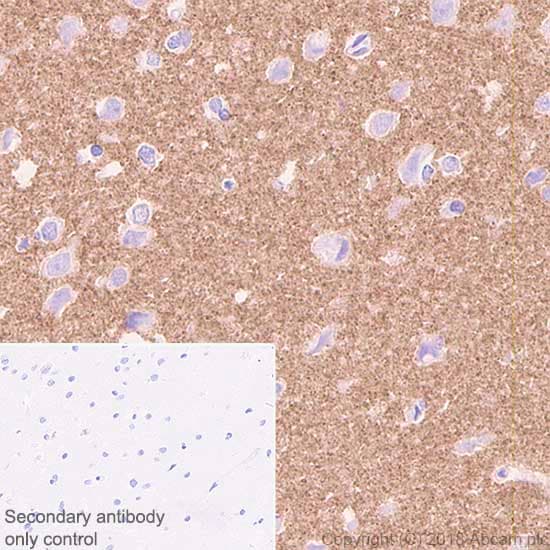Anti-VGluT1 antibody [EPR22269](ab227805)
