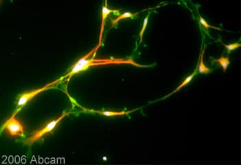 Anti-KCNQ2 antibody(AB22897)