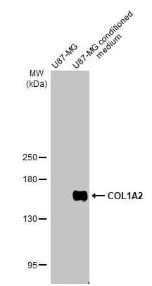 Col1a2 Antibody Hl2049 Ab308221  Western Blot Img407107