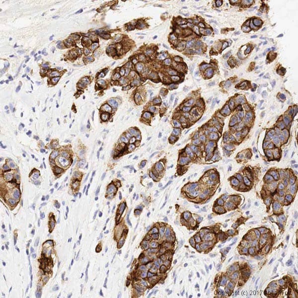 Muc1 Antibody Sm3 Ab22711  Immunohistochemistry Formalin Pfa Fixed Paraffin Embedded Sections Img15588