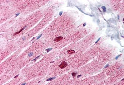 Phap1 Antibody C Terminal Ab189110  Immunohistochemistry Formalin Pfa Fixed Paraffin Embedded Sections Img91281