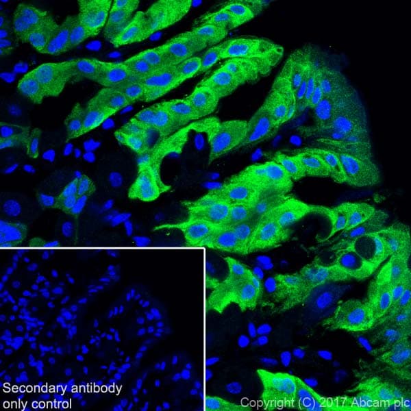 Gsdma Antibody Epr19858 17 Ab214818  Immunohistochemistry Frozen Sections Img128592