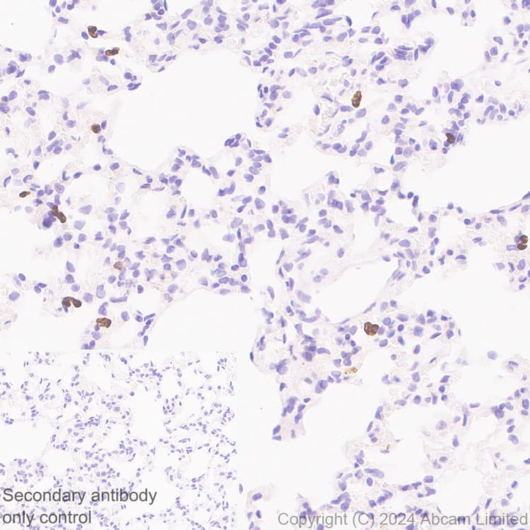 Ykl 40 Chi3l1 Antibody Rm1204 Bsa And Azide Free Ab319165  Immunohistochemistry Formalin Pfa Fixed Paraffin Embedded Sections Img434083