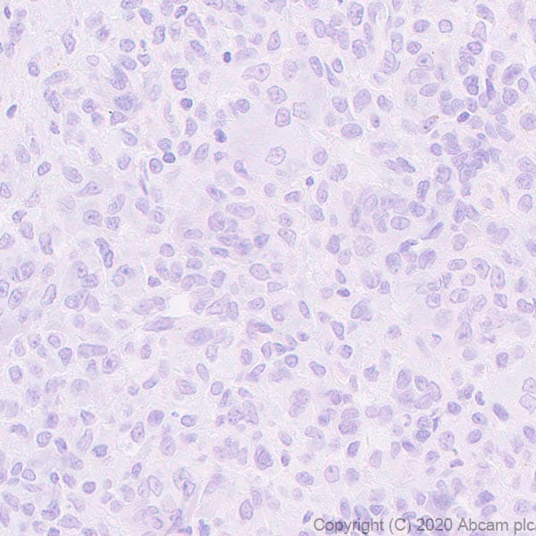 Anti-Histone H3 (mutated K36M) antibody [EPR23614-91] - BSA and Azide free(AB270796)