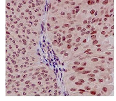 Anti-EXOSC3 antibody [EPR14840(B)] - N-terminal(AB184961)