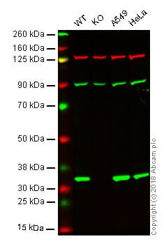 Anti-Syntenin antibody [EPR8102](AB133267)