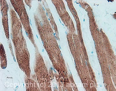 Anti-Glucose Transporter GLUT4 antibody(AB33780)