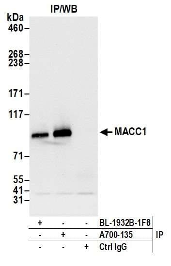 Anti-MACC1 antibody [BLR135H] - BSA free(AB314047)