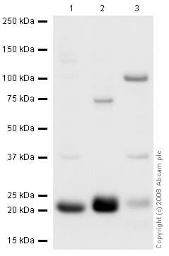 Anti-TAGLN/Transgelin antibody(AB14106)