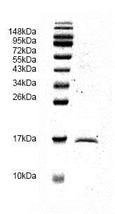 Ab82991  Sds Page Img81609