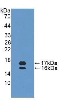 Ccl28 Mec Antibody Ab232837  Western Blot Img10875