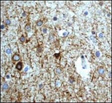 Anti-Neurofilament heavy polypeptide antibody [EP673Y] - BSA and Azide free(AB247290)