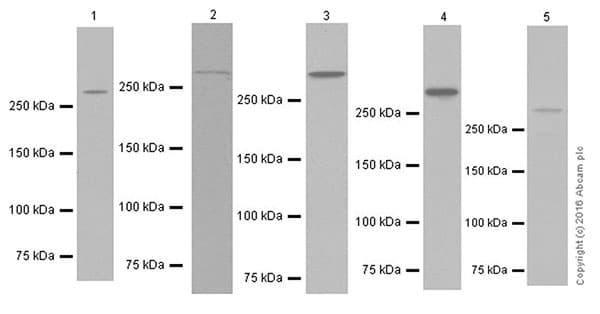 Anti-ATM antibody [EPR20100] - ChIP Grade(AB201022)