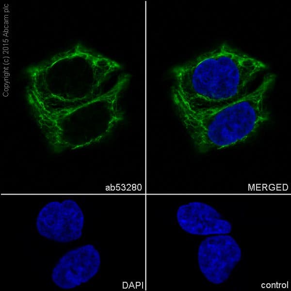Anti-Cytokeratin 8 antibody [EP1628Y] - Cytoskeleton Marker(AB53280)