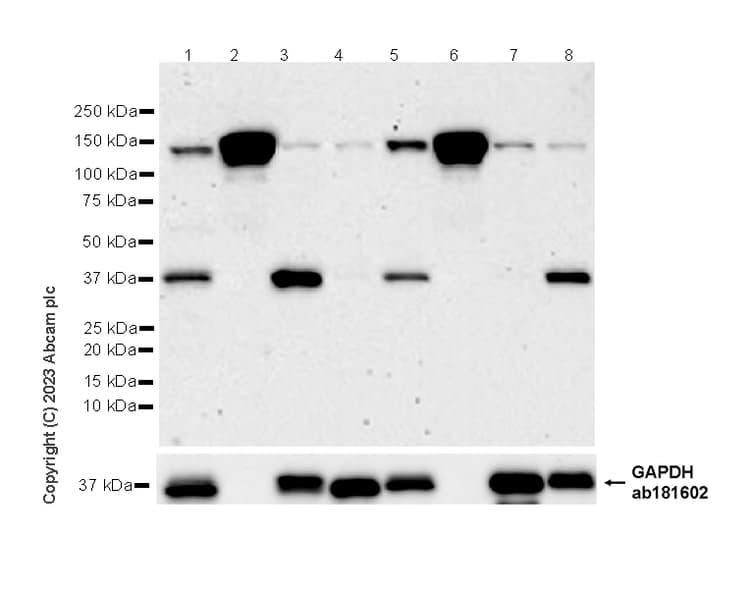 Ceruloplasmin Antibody Epr28432 1 Bsa And Azide Free Ab314669  Western Blot Img421776
