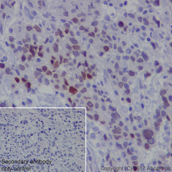 Anti-FOXC1 antibody [EPR20685](ab227977)