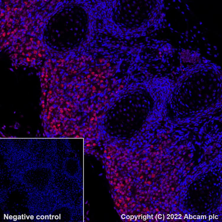Alexa Fluor® 647 Anti-BRN3A antibody [EPR23257-285](AB300744)
