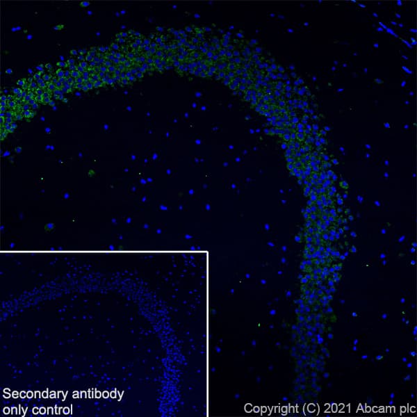 Scn1a Antibody Epr22326 112 Ab222091  Immunohistochemistry Frozen Sections Img133964