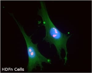 Nucleolin Antibody 364 5 Ab136649  Immunocytochemistry Immunofluorescence Img95409