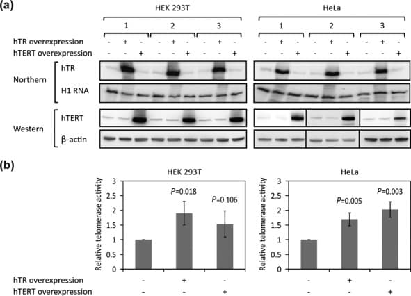 Anti-Telomerase reverse transcriptase antibody [Y182](AB32020)