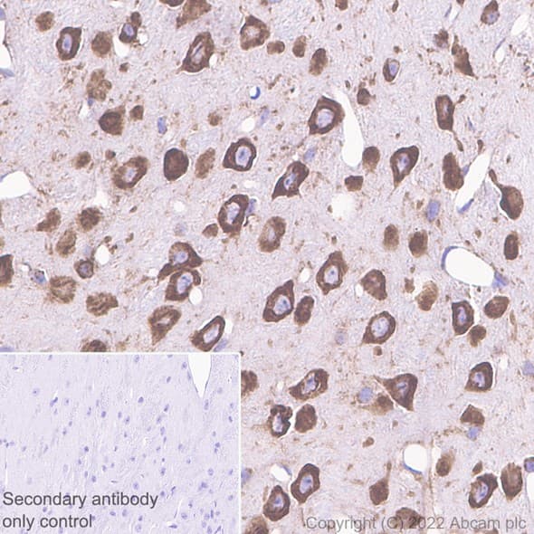 Rpl9 Antibody Ep13752 Bsa And Azide Free Ab284834  Immunohistochemistry Formalin Pfa Fixed Paraffin Embedded Sections Img407587