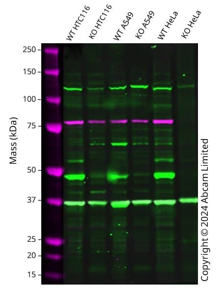 Anti-Vitamin D Receptor antibody [EPR4552] - ChIP Grade(AB109234)