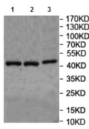 Bckdhb Antibody Ab201225  Western Blot Img70617