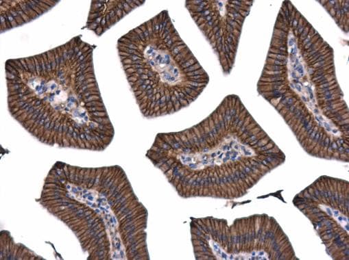 Anti-beta Catenin antibody - ChIP Grade(AB227499)