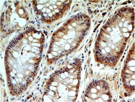 Caspase 3 Antibody Abm1c12 Ab208161  Immunohistochemistry Formalin Pfa Fixed Paraffin Embedded Sections Img87424
