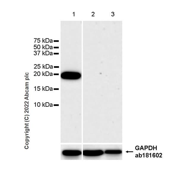 Anti-RBP1 antibody [42/RBP](AB307683)