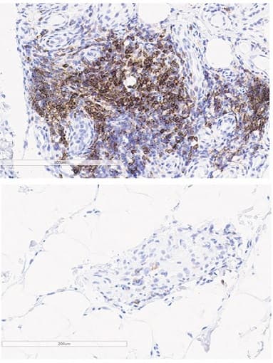 Anti-PD1 antibody [EPR4877(2)](AB137132)