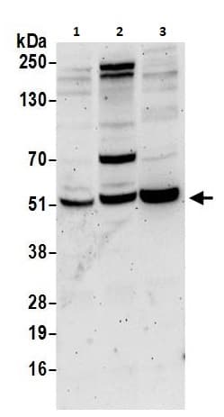 Ppp2r2b Antibody Ab264160  Western Blot Img62398
