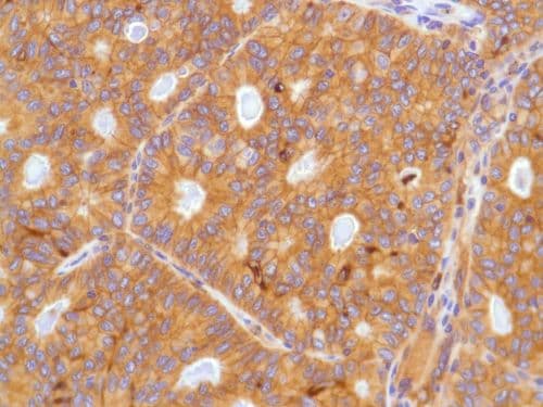 Egfr Antibody Sp84 Bsa And Azide Free Ab238803  Immunohistochemistry Formalin Pfa Fixed Paraffin Embedded Sections Img130181