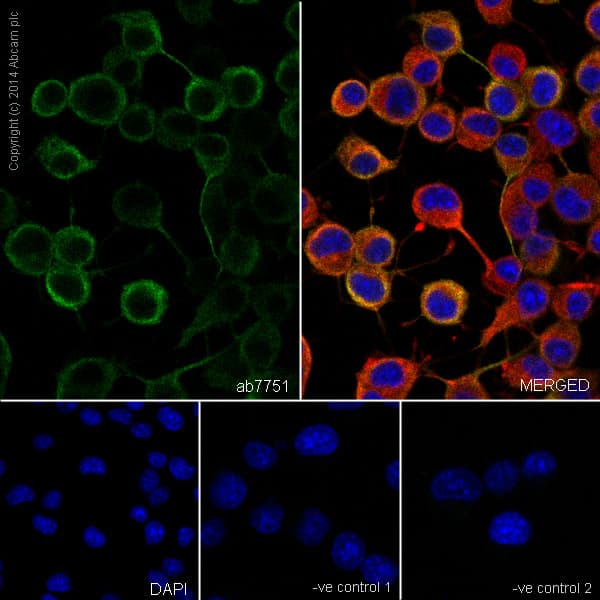 Anti-beta III Tubulin antibody [TU-20] - Neuronal Marker(ab7751)