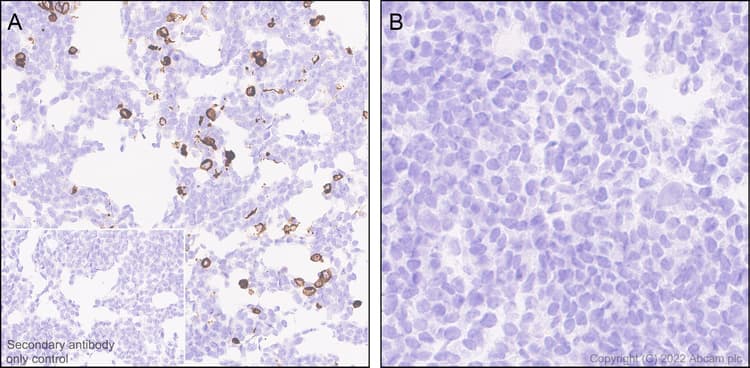 Anti-Mu Opioid Receptor antibody [EPR26293-61](AB302512)