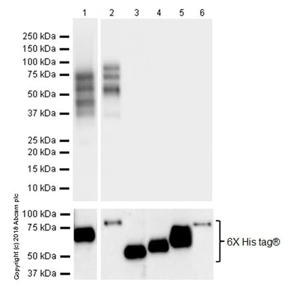 Anti-2N Tau antibody [EPR21723](ab218316)