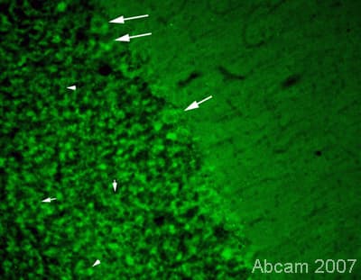 Cacna1a Antibody Ab32642  Immunohistochemistry Pfa Perfusion Fixed Frozen Sections Img133167