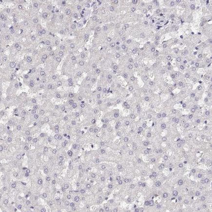 Anti-NUT antibody(AB122649)