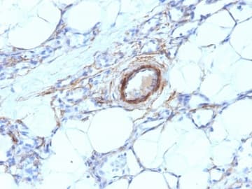 Smooth Muscle Myosin Heavy Chain I Antibody Myh11 923 Ab233940  Immunohistochemistry Formalin Pfa Fixed Paraffin Embedded Sections Img25677