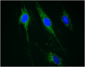 Anti-CPT1A antibody [8F6AE9](AB128568)