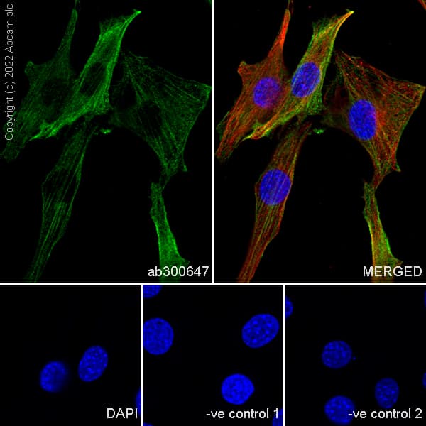 Goat Anti-Rat IgG H&L (Alexa Fluor® 488)(AB150157)