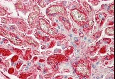 Anti-Fibrinogen beta chain antibody(AB219355)