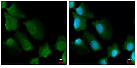 Anti-14-3-3 sigma/SFN antibody(AB151504)