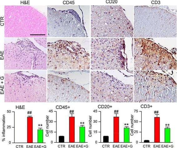 Anti-CD45 antibody(AB10558)